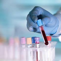 Genes Explained CYP2R1